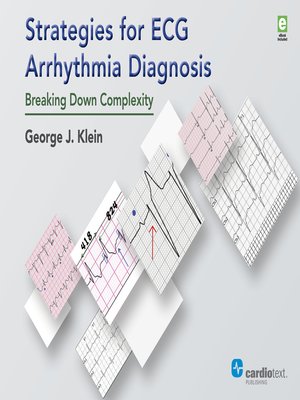 cover image of Strategies for ECG Arrhythmia Diagnosis